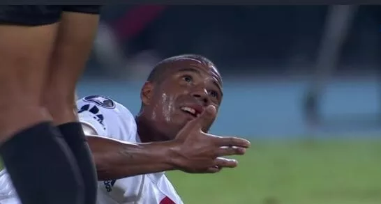 SABIA QUE DE LA CRUZ JA PERDEU UM DENTE EM JOGO CONTRA O FLAMENGO? CONFIRA...