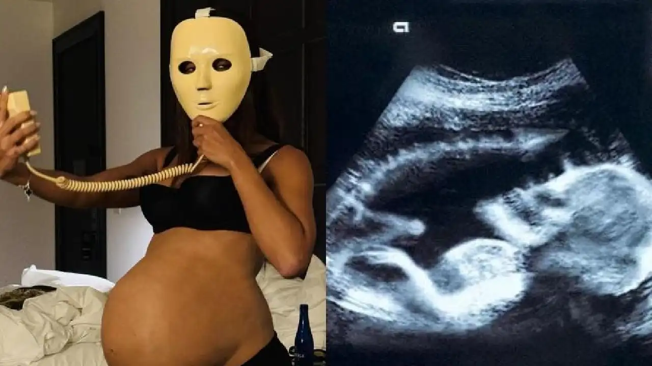 Anitta compartilha imagem de ultrassom misteriosa  - Foto: Reprodução