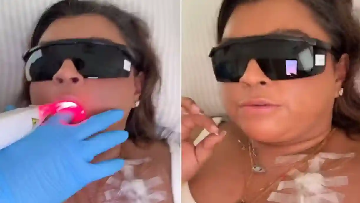 Preta Gil compartilha tratamento com laserterapia (Reprodução/ Instagram)