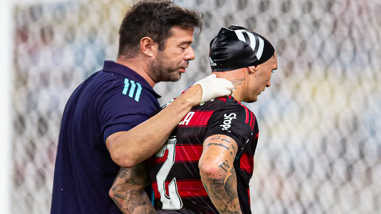 Varela sofre corte na cabeça e leva 10 pontos após partida do Flamengo